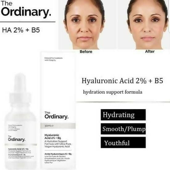 The Ordinary Most-Loved Set