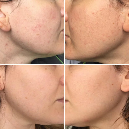 The Ordinary Glycolic Toning Solution 7% | Natural Moisturizing Factors + HA | Alpha Arbutin 2%+ HA